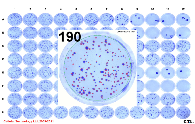 エムエステクノシステムズ コロニー プラークカウント等のバイオアッセイ解析